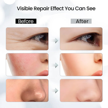 Led Face Mask - 7 Color Light Therapy for Anti-Aging, Acne & Wrinkles, Gift for Women